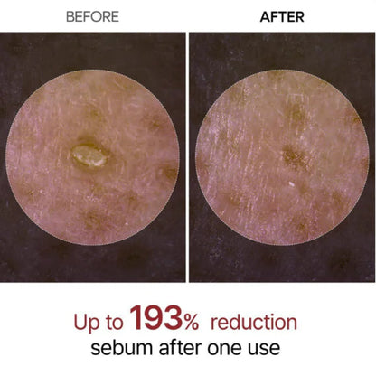 Glow Rice Peeling Ampoule